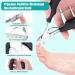 Jupeli Professional Toenail Clip Set - Sharp Stainless Steel Nail Clippers for Thick & Ingrown Nails 8PC Pedicure & Manicure Kit with Nail Scissors Shapers & Files - Perfect Foot Care Solution - Buy Online on GoSupps.com