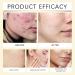 Turmeric Kojic Cleansing Pads | Turmeric Exfoliate Pads For Face | 40 Turmeric Kojic Cleansing Pads | Exfoliation Pads For Cleansing And Exfoliation - Buy Online on GoSupps.com