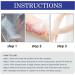 EXQST 30ml Psoriasis Repair Spray - Herbal Treatment for Skin Plaque Psoriasis - Stops Burning and Itching - 3pcs - Buy Online on GoSupps.com