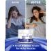 GBN Magnesium Cream - Hydrating Magnesium Lotion for Sleep - Natural Relaxation & Muscle Tension Nighttime Butter for Feet Leg Cramps Safe for Kids (Lavender) 4.2 Ounce (Pack of 1) - Buy Online on GoSupps.com
