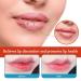 Healing Lip Balm for Dry Cracked Lips | Natural & Organic Cheilitis Treatment for Men Women & Children | Dermatologist Recommended All-Day Moisture - Buy Online on GoSupps.com