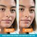 Nexcare Acne Absorbing Covers 108/pack 108 Count - Buy Online on GoSupps.com