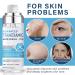 Buy Tranexamic Acid Serum - Discoloration Correcting Face Lotion | Natural Moisturizing Skincare | International Shipping - Buy Online on GoSupps.com