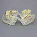 Shop Dental Malocclusion Orthodontic Treatment Model - Metal Brackets & Colorful Ties | M3005 - International Shipping Available - Buy Online on GoSupps.com