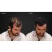 LUXE Hair Thickening Fibers - Hypoallergenic, Dermatologist Tested - 2 Months+ Supply in Dark Brown - Buy Online on GoSupps.com
