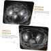 Alipis 2pcs Candy Fondant Mold Chocolate Molds Plastic Ball Shape Cookie Mold Chocolate Ball Jelly 3D WXQ130654I19U - Buy Online on GoSupps.com