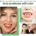 KLYso Portable Press-Type Teeth Whitening Foam Toothpaste - Remove Tartar & Stains Cleanse & Protect Gums Brighten & Whiten Teeth(2PCS) - Buy Online on GoSupps.com