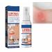 Lipoma Removal Spray Lipoma Reduction Anti-cellulite Body Shaper Spray for Men and Women 50ml