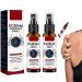 DUBUSH Eczema Therapy Spray Psoriasis Relief Spray Fast Acting Itch Relie Spray Eczema Soothing and Hydrating Cream Moisturize Soothe Dry Skin 2 Pcs
