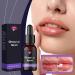  Generisch Moisturizing lip oil - Moisturizing oil for dry lips - Glossy treatment for women and girls - Buy Online on GoSupps.com