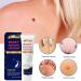 Svevno WartOff Instant Blemish Removal Cream - Effective Wart, Corn & Callus Remover - 1PC - Buy Online on GoSupps.com