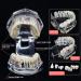 Buy Youya Transparent Dental Tooth Model for Dentists | Removable Pathological Teaching Model | International Shipping Available - Buy Online on GoSupps.com
