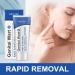 Maximum Strength Wart Remover Cream - Fast-Acting Salicylic Acid Gel for Genital Warts - International Shipping Available - Buy Online on GoSupps.com