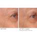NassifMD Eye Renewal Cream | Anti-Aging Firming Eye Cream for Dark Circles & Puffiness | Best Eye Cream for Women - Buy Online on GoSupps.com