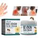 Bee Venom Cream Bienergiftsalbe Beeengift against Warzen Cream Bee Venom Pain Cream Bienengift Salbe Biengift cream pain ointment bee venom ointment 1 piece of Bienengiftsalbe