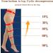 Haodasi Class 2 Medical Compression Pantyhose - Graduated Support Hosiery for Varicose Veins - Women's Beige Compression Stockings - Buy Online on GoSupps.com