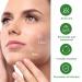 Hydrocolloid Acne Blemish Patch Fast Healing for Clear Skin | International Shipping Available - Buy Online on GoSupps.com
