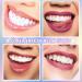 LFLIFENG Tooth Jewelry - 8 Stylish Tooth Gem Kits for Social Gatherings & Special Occasions - Unique Tooth Stones - Buy Online on GoSupps.com