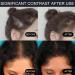 Instantly Hairline Powder Hair Root Dye Fill Forehead Root Concealer Instantly Conceals Hair Windproof Sweat-Proof Hair Touch-Up for Natural Looking 27.5g Dark Brown - Buy Online on GoSupps.com