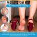 U-Shaped Felt Callus Pads (48 Pack) | Self-Stick Foot Cushions for Pain Relief | Protect Against Rubbing & Reduce Discomfort - Buy Online on GoSupps.com