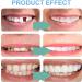 Instant Smile Makeover: Presses Fake Teeth Temporary Dentures & Cosmetic Veneers - Shop Internationally! - Buy Online on GoSupps.com