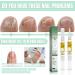 Buy Nail Care Pen Set | 2 Pieces Nail Hardener & Treatment for Healthy Nails - Fast & Effective Repair for Broken Nails & Fungal Infections - Buy Online on GoSupps.com