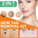 2-IN-1 Skin Tag Tool Kit for Men and Women Fast and Easy Micro Skin Tags Skin Tag Tool Kit for Medium to Large Skin Tags (2mm-7mm) Complete Skin Tag Tool Kit Safe for Most Parts - Buy Online on GoSupps.com