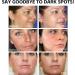 Dark Spot Correcting Serum Anti Ageing Face Serum with Niacinamide Hyaluronic Acid Serum Dark Spot Remover for Face Skincare Brightening Serum Reduce Age Spots Fine Lines Hyperpigmentation - Buy Online on GoSupps.com