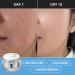 GLASS SKIN 14 Days Miracle Retinol Night Cream - Korean Skincare Anti-Aging Moisturizer for Face & Neck with Collagen & Centella - 1.69oz - Buy Online on GoSupps.com