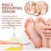 7 Days Nail Growth and Strengthening Serum Nail Serum for Strength and Growth Nail Repair Essence Serum Toenail Growth Treatment Restores The Healthy Natural Appearance of Nails - Buy Online on GoSupps.com