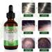 Organic Rosemary Hair Growth Oil - Cold Pressed, 4.04 Oz (Pack of 2) for Hair, Body & Skin - Buy Online on GoSupps.com