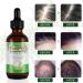 Rosemary Hair Growth Oil | Hair Loss Treatment | Stimulates Growth, Strengthens & Nourishes Scalp | For Men & Women | 2.02 Oz - Buy Online on GoSupps.com