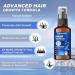 Buy 5% Minoxidil Hair Growth Serum | Hair Regrowth Treatment for Men & Women | Thicker Stronger Hair | 60ml - 1 Month Supply - Buy Online on GoSupps.com