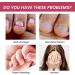 Anti Nail Biting Nail Polish Stop Nail Repair Nail Varnish Stop Biting Your Nails Nail Biting Prevention Clear Nail Varnish Nail Biting Treatment For Adults & Children Fast and Easy Application 2PCS - Buy Online on GoSupps.com