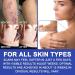 Professional Grade Silicone Scar Removal Sheets - 1.6 x 120 3M - For C-Section Surgery, Burn, Acne, Stretch Marks - Works on Old & New Scars - Reusable - Buy Online on GoSupps.com
