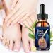 Ingrown Toenail Soother | 15 ml Nourishing Liquid | Nail Care Drops - For Dryness Redness Thickening Women Men Home Manicure Salon Pedicure Preparation - Buy Online on GoSupps.com