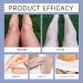 Intimate Area For Dark Spot Correction Armpit Underarm Armpit Elbow Inner Thigh And Knee Oisturizing Skin Dark Spot Remover For Sun Spots (3) - Buy Online on GoSupps.com