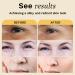 ANAI RUI Turmeric Oil - Dark Spot Treatment & Moisturizing Facial Serum 1.06oz - Buy Online on GoSupps.com