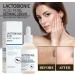 Lactobionic Acid Pore Refining Serum Lactobionic Acid Pore Shrink Face Serum Shrink Pore Reduce Fine Lines Facial Liquid Lactobionic Acid Skin Tightening Oil for Face Anti-Wrinkle 30ml - Buy Online on GoSupps.com