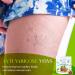 Varicose Veins Treatment For Legs 500 ml / 17 oz Horse Chestnut Gel Cream Restless Leg Syndrome Relief Varicose Veins Relaxing Cooling Soothing Cream for Aching Feet Legs Knees Back - Buy Online on GoSupps.com
