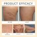  HNYXEQJL Set of 4 skin treatment creams: moisturizing cream to remove dead skin cells firming serum for the whole body deep-acting moisturizing and wrinkle-reducing - Buy Online on GoSupps.com