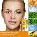 FROPUN Bee Venom Treatment Cream | Acne & Skin Repair | Hydrating Cream for Men & Women | 1 Fl Oz - Buy Online on GoSupps.com