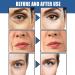5 Seconds Wrinkle Remover 5 Seconds Retinol Anti-Wrinkle Cream 5 Seconds Anti Wrinkle Face Cream Instant Wrinkle Remover Lifting Moisturizing Facial Cream Tightening Face Cream or Women - Buy Online on GoSupps.com