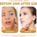 Tallow Honey Balm Tallow Moisturizer Firming Face Cream Tallow Face Cream Tallow Balm Instant Wrinkle Remover Tallow And Honey Balm Repair Barrier Face & Body Moisturiser For Dry Skin 30g - Buy Online on GoSupps.com