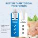 Vitality Now Fungus Exodus - 60 Capsules for Healthier Feet | Premium Formula - Buy Online on GoSupps.com