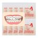 Dental Orthodontic Elastics - 10 Packs (1000 Pcs) Rubber Bands - 5/16" - Latex - International Shipping - Buy Online on GoSupps.com