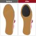 Sibba Non Slip Shoe Pads - 6 Pcs Adhesive Sole Protectors for Women | Anti-Slip High Heel Grips & Comfortable Insoles - Buy Online on GoSupps.com