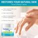iTecFreely Psoriasis Cream: Fast & Effective Scalp Treatment for Dry Scalp, Dandruff & Eczema - Face and Body Relief - Buy Online on GoSupps.com