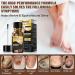 Extra Strength Toenail Treatment - Nail Treatment for Fungus & Discoloration (1 fl oz/30 ml) | Effective Toe Nail Solutions - Buy Online on GoSupps.com