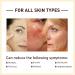  homomdy Rice Anti-Wrinkle Whitening Face Serum Rice Moisturizing Serum Niacinamide Nourishing and Firming Face Cream Evens Complexion Repairs and Nourishes Dry Skin (6pcs) - Buy Online on GoSupps.com